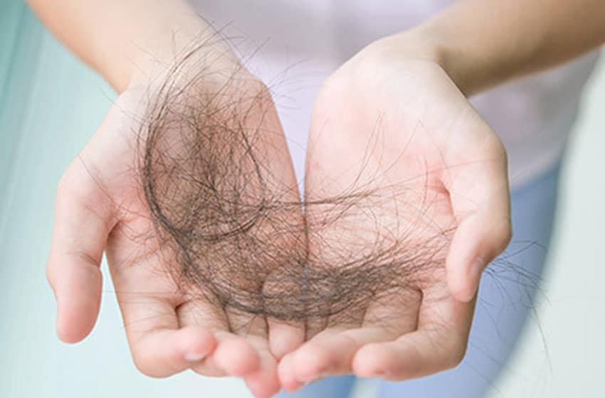 دلیل و نوع ریزش موی شما کدام است؟