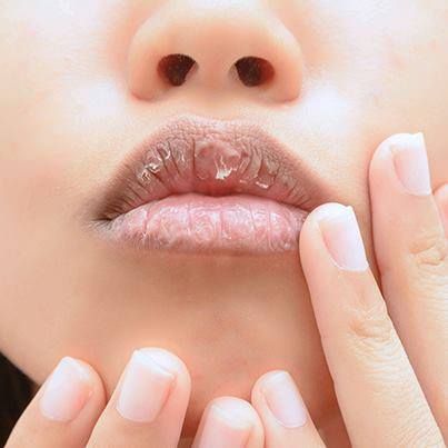 خشکی لب-خانومی