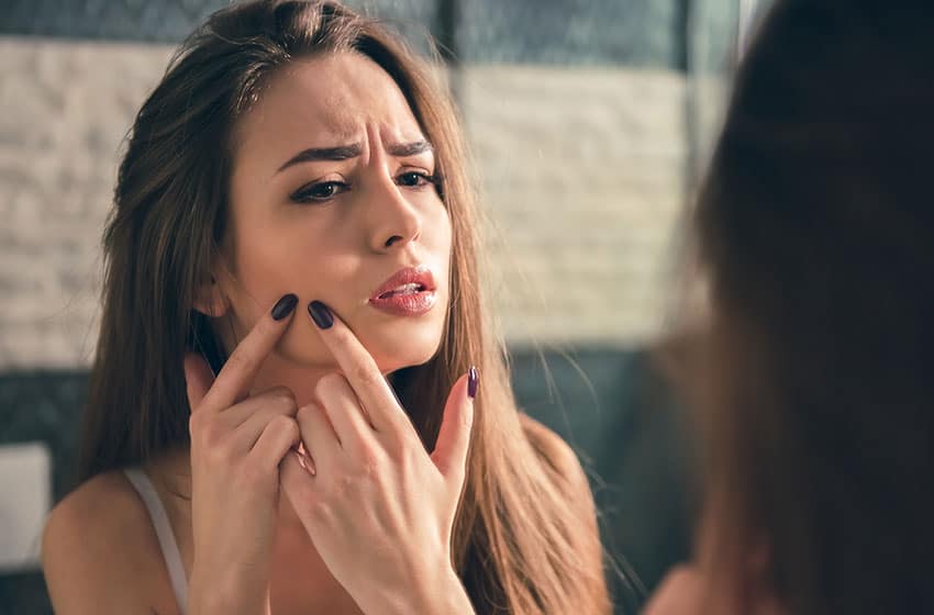 درمان سریع جوش صورت-خانومی