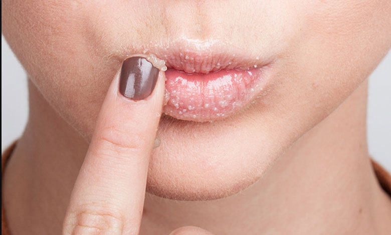 رفع سیاهی لب در خانه