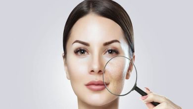 درمان منافذ باز پوست