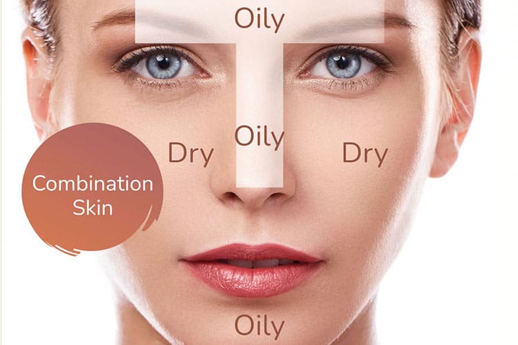 ویژگی منطقه تی زون پوست ترکیبی