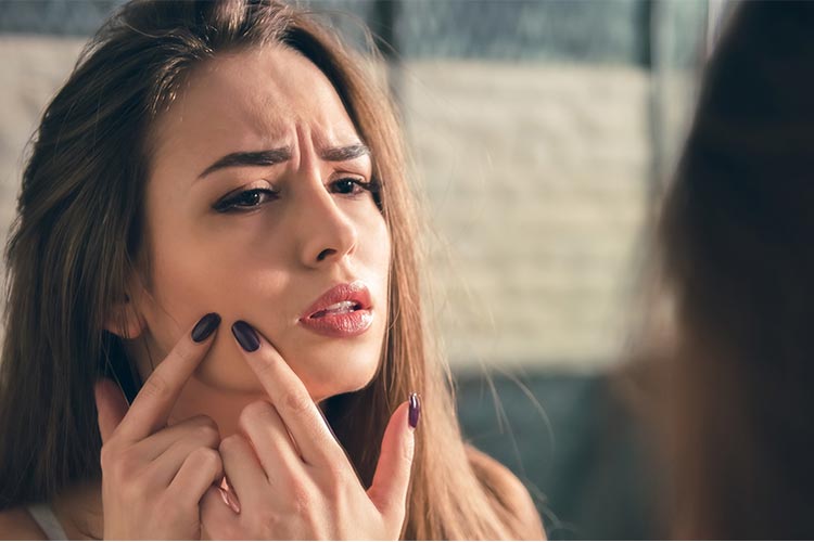 دلایل اصلی جوش زدن