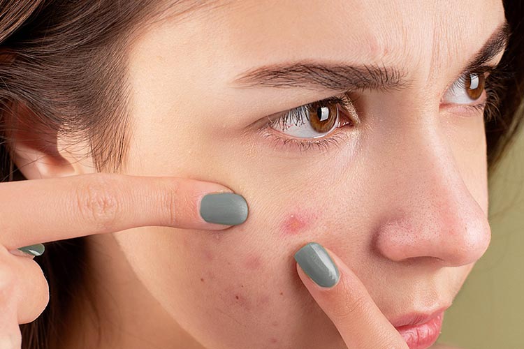 راهنمای خرید ضد جوش