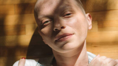 مراقبت از پوست و مو و ناخن در دوران شیمی درمانی و بعد از آن