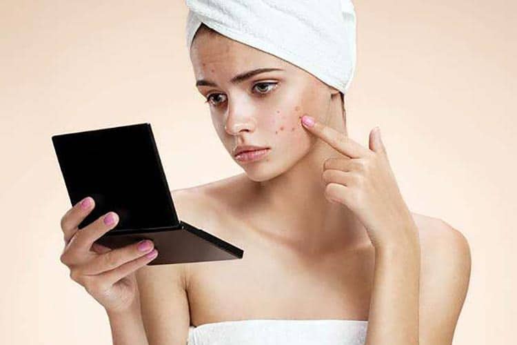 ماسک خیار برای جوش صورت
