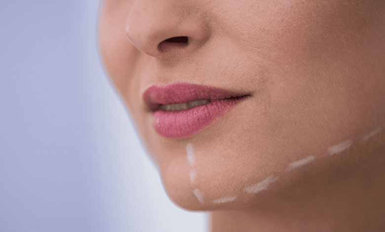 کانتور کردن گونهها و فک