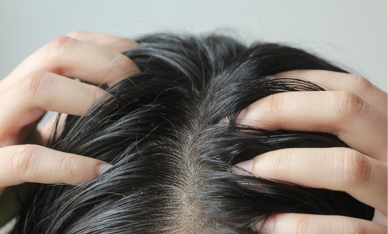 دلیل ریزش مو در مردان و زنان