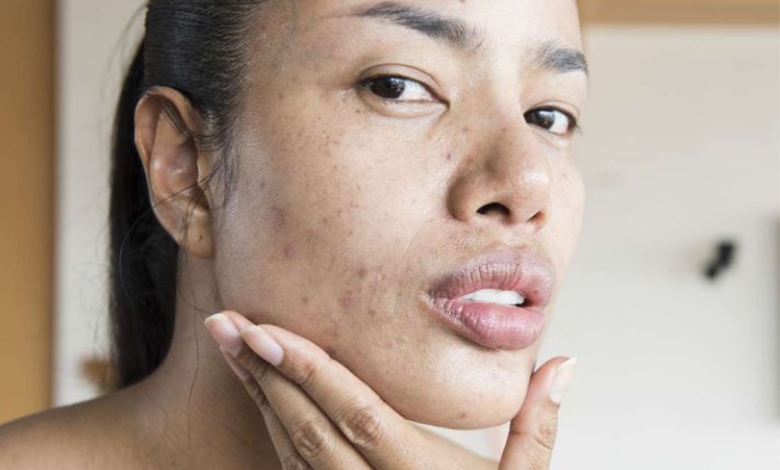 مزایای استفاده از رتینول برای پوست