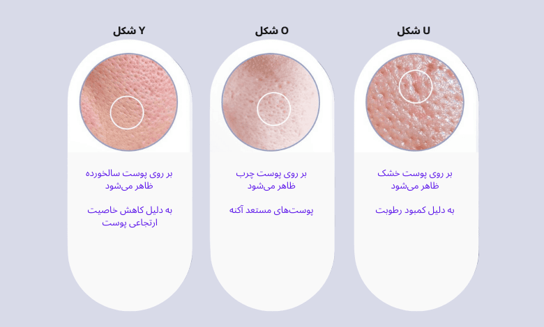انواع منافذ باز