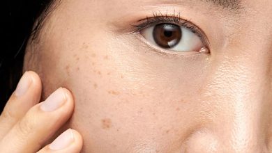 سریع‌ترین راه از بین بردن لک قهوه‌ای صورت