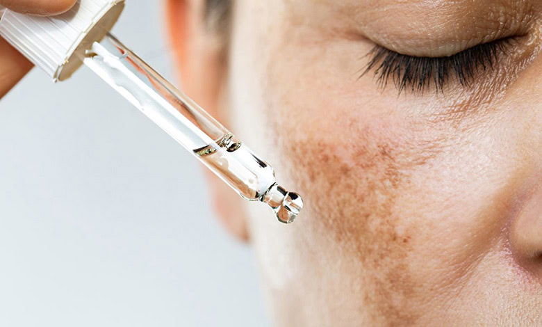 روشنکننده هگزیل رزورسینول