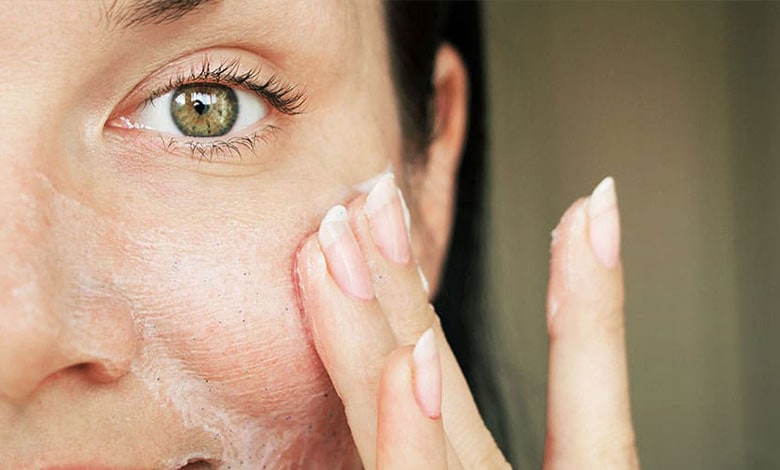 درمان جوش صورت