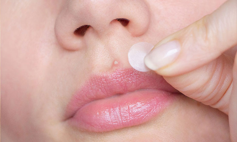 از بین بردن جوش صورت