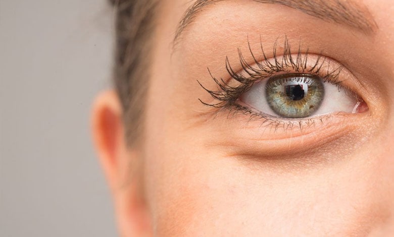 کمبود کدام ویتامین باعث پف زیر چشم میشود؟