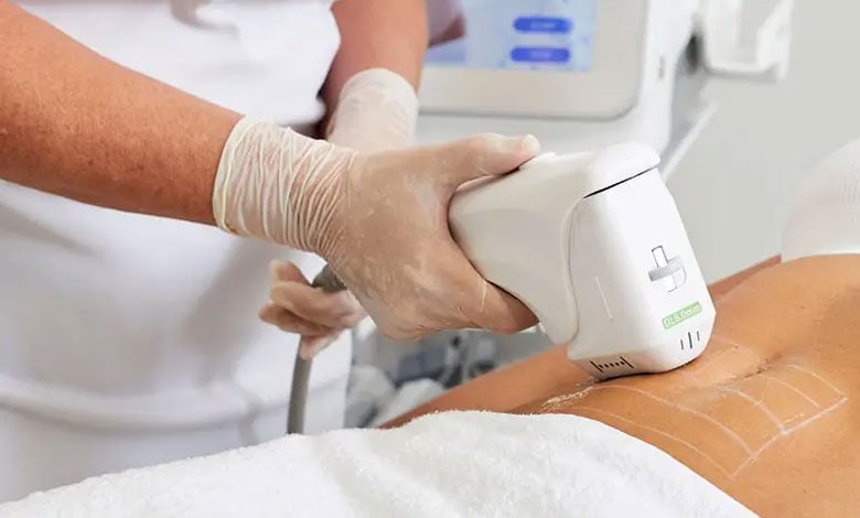 کاربرد دستگاه هایفو برای پوست