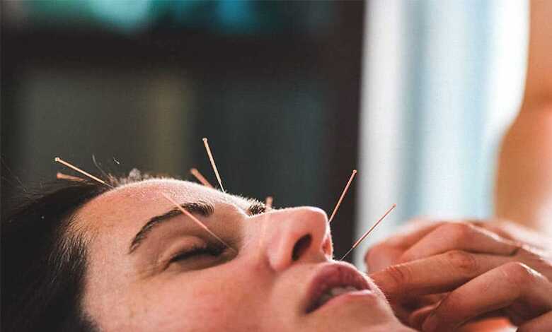 طب سوزنی برای رفع سیاهی زیر چشم