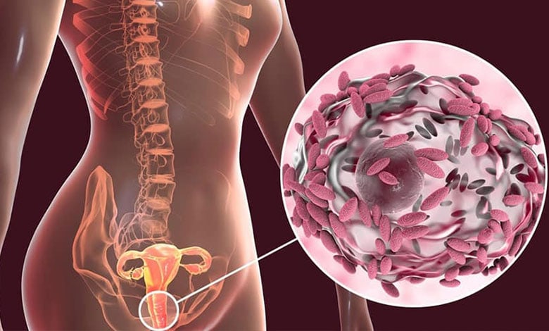 واژینوز باکتریایی