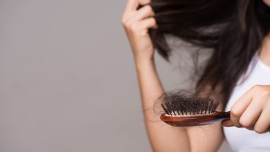 علت ریزش مو در زنان