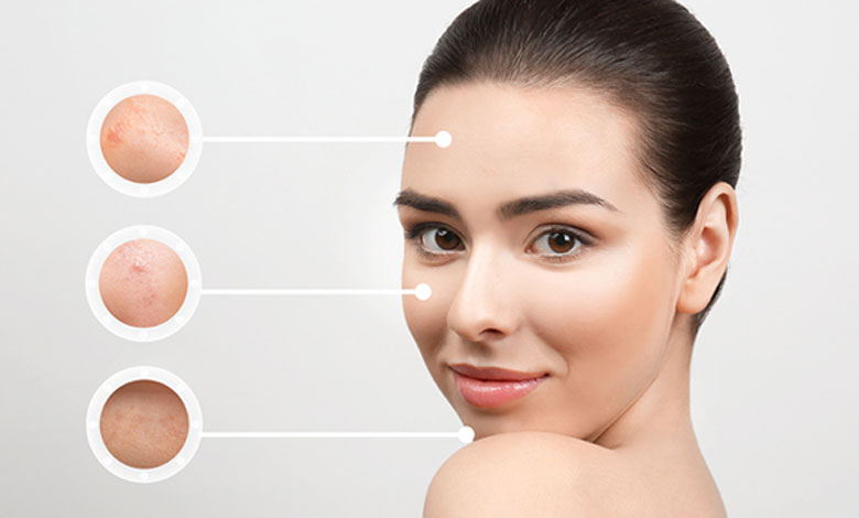 دستگاه جوانساز پوست چیست