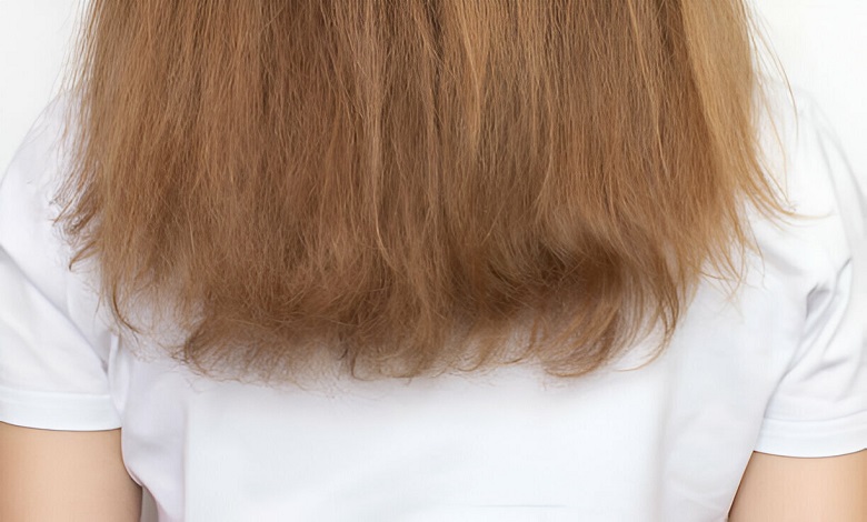 موخوره نشانه خشکی مو