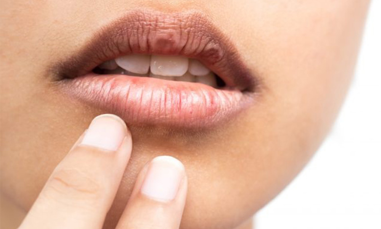 پیشگیری و درمان کمبود بیوتین