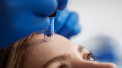 مراقبت بعد از میکرونیدلینگ