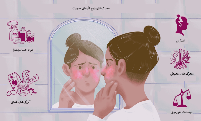 محرکهای رایج اگزما