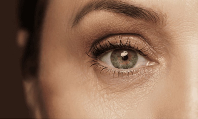 درمان خشکی دور چشم