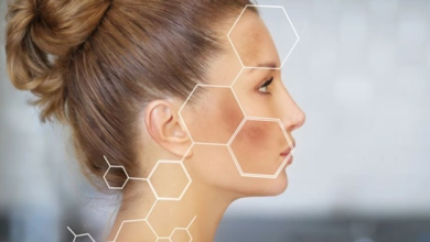 کمبود چه ویتامینی باعث تیرگی پوست میشود؟