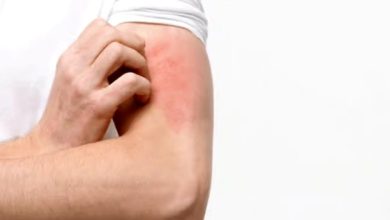 کمبود کدام ویتامین باعث خارش بدن میشود؟