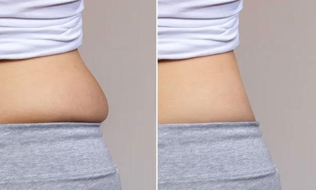 بهترین مکمل چربی سوز شکم و پهلو؛ راهنمای انتخاب مکمل