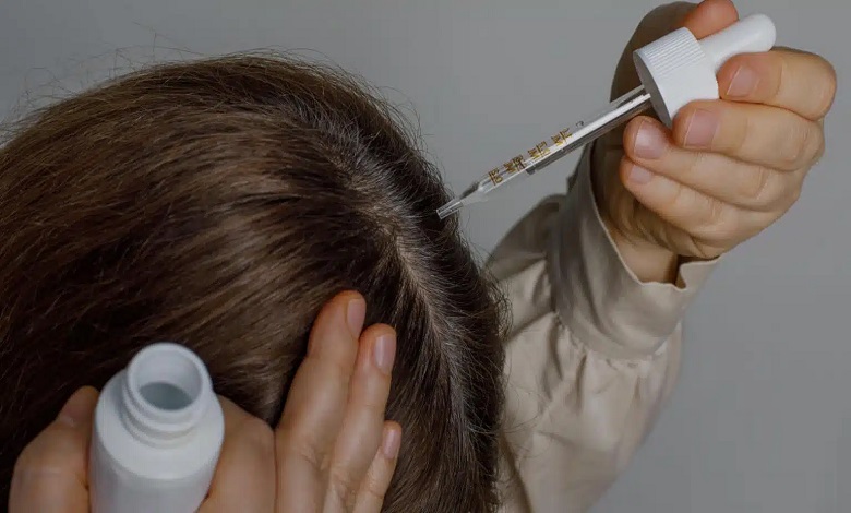 ماینوکسیدیل چیست؟ تفاوت ۲٪ و ۵٪، نحوه مصرف و عوارض