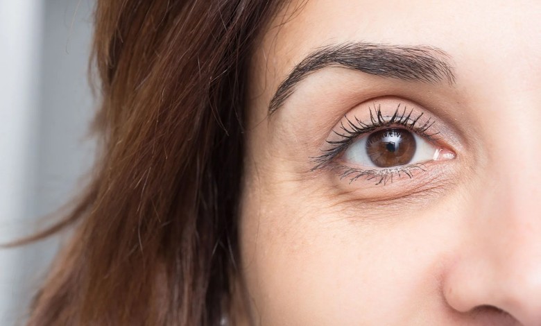 بهترین کرم برای سیاهی دور چشم؛ چطور سیاهی دور چشمها را از بین ببریم؟