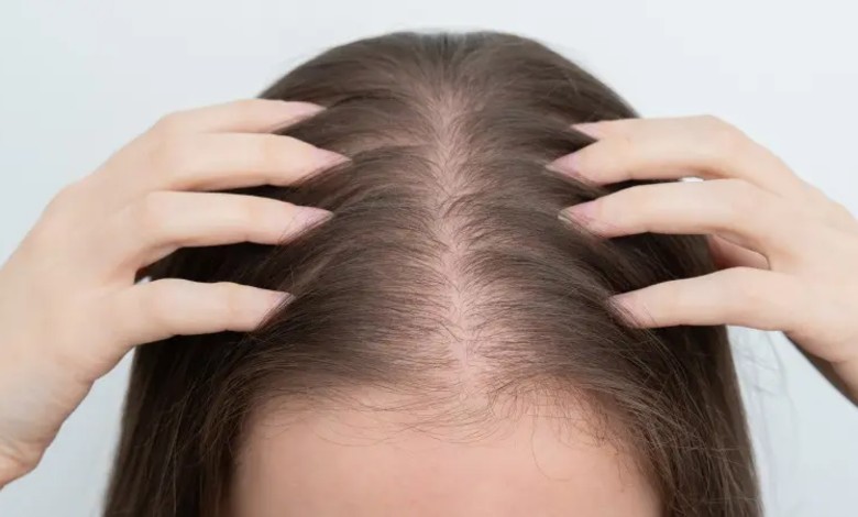 معرفی بهترین شامپو برای ریزش مو خانم ها ایرانی و خارجی