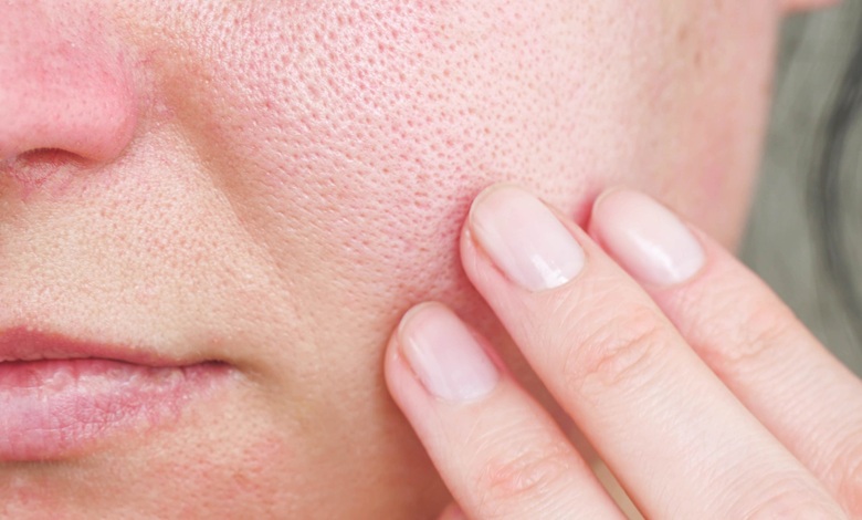 بهترین ماسک خانگی برای منافذ باز پوست