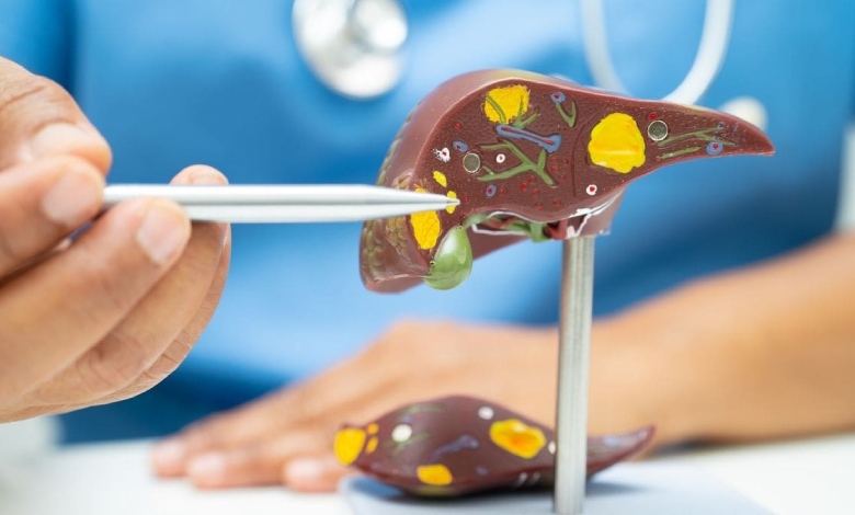 کمبود چه ویتامینی باعث زردی پوست میشود؟