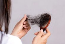 آیا ریزش مو در بارداری طبیعی است؟