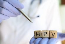 آیا زگیل تناسلی خود به خود درمان میشود؟ + راه های درمان زگیل تناسلی