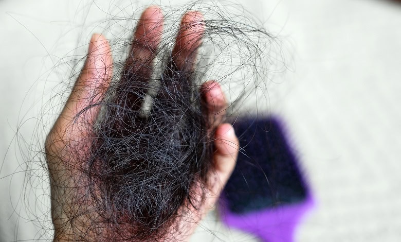 آیا ریزش مو در بارداری طبیعی است؟