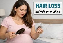 آیا ریزش مو در بارداری طبیعی است؟ [راهنمای جامع + نحوه جلوگیری]