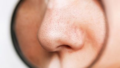 روش های از بین بردن منافذ باز بینی؛ رهایی از حفرههای روی بینی