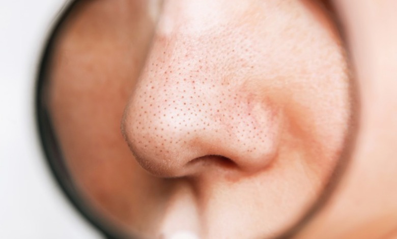 روش های از بین بردن منافذ باز بینی؛ رهایی از حفرههای روی بینی