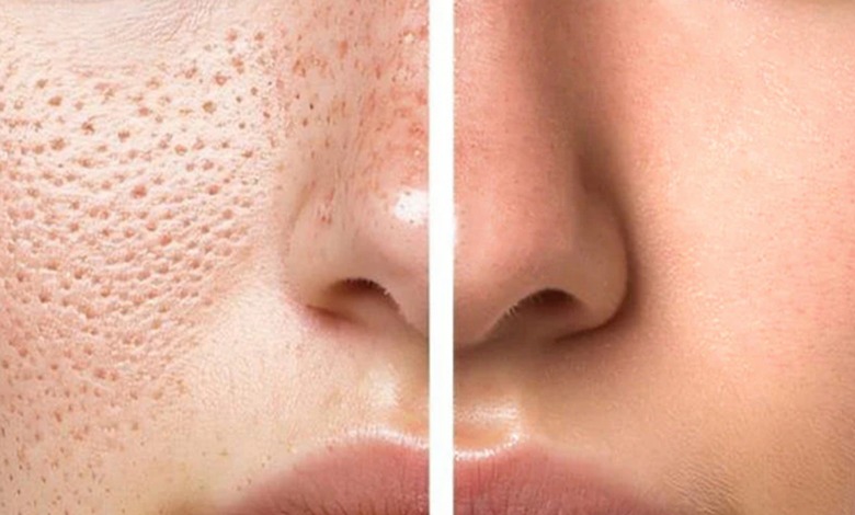 منافذ باز بینی