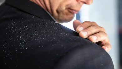 روش درمان پوسته پوسته شدن سر + علت پوست انداختن کف سر