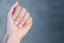 اصلی ترین علائم کمبود کلسیم چیست؟