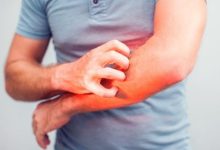 برای خارش بدن چه بخوریم