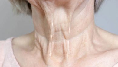 علت ایجاد خطوط گردن و راههای از بین بردن آن چیست؟