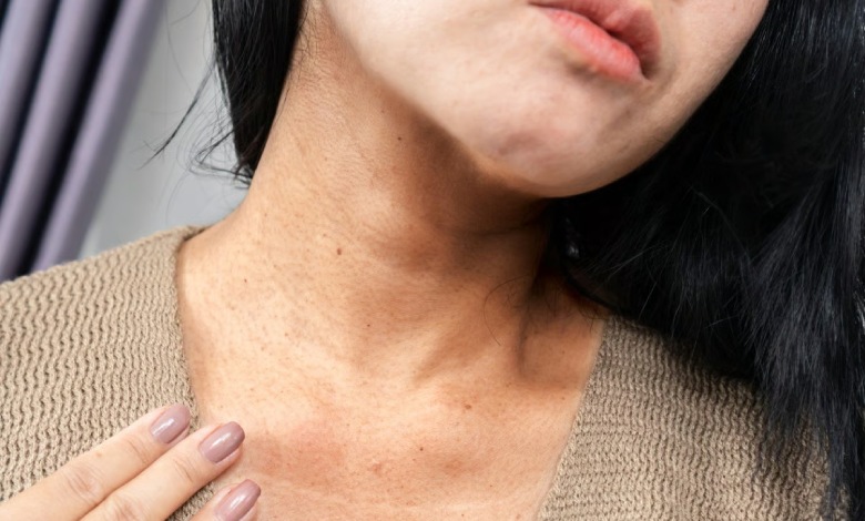 بررسی علل ایجاد خطوط گردن