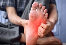 برای سوزش کف پا چی بخوریم؟ درمان خانگی و داروهای مؤثر